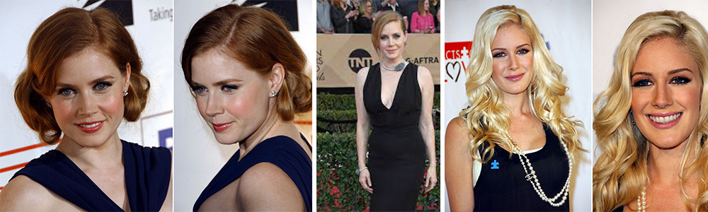 Amy Adams Hair Transplant