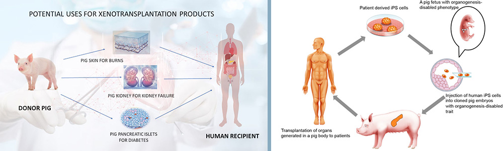 The transplantation of animal organs in human bodies