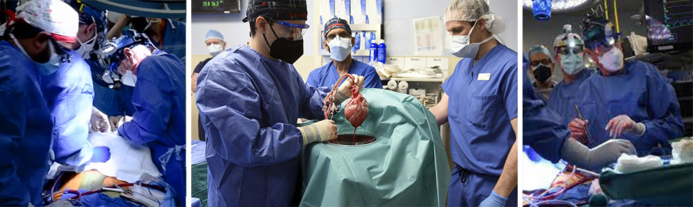 The world’s first transplantation of a pig heart to a human
