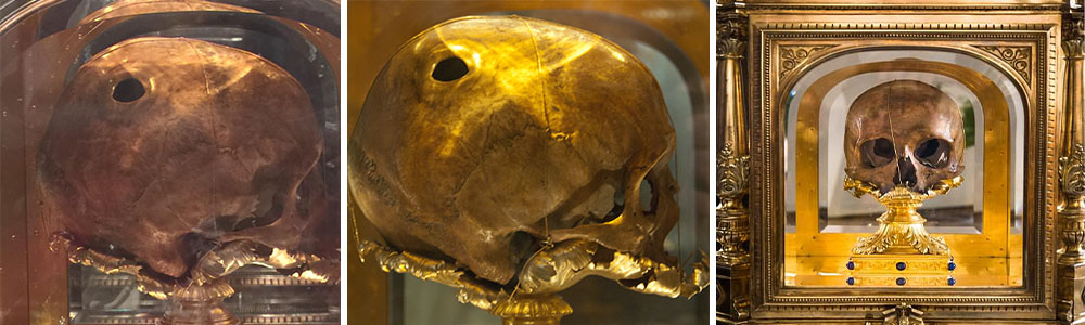 St. Aubire's Skull with the burnt hole