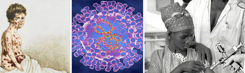 Worldwide Distribution of the vaccine; The World’s First Vaccination